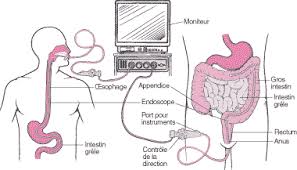 Wain Etienne – Gastro-Entérologie & Maladie du foie